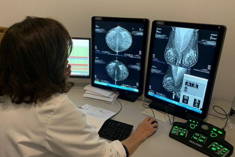 Salud incorporará la doble lectura de pruebas de cribado de cáncer de mama mediante inteligencia artificial